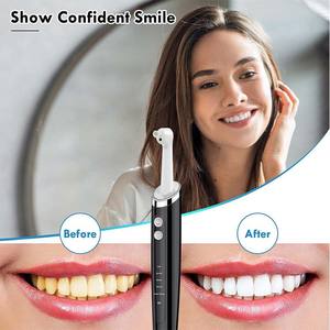 Machine à polir les dents à usage domestique, polisseur électrique portable rechargeable avec 3 pâtes, 5 têtes de brosse, composants en plastique - Product Image 6