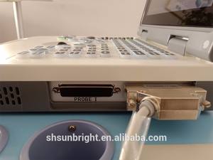 Peralatan <span class=keywords><strong>Ultrasound</strong></span> medis mesin <span class=keywords><strong>Ultrasound</strong></span> <span class=keywords><strong>Laptop</strong></span> B/2B/4B/M mesin <span class=keywords><strong>Ultrasound</strong></span> kehamilan manusia - Product Image 3