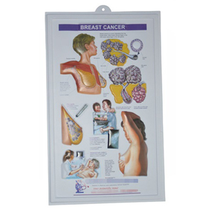 Tùy Chỉnh Nhựa PVC Dập Nổi Y Tế Mắt Poster Mắt Người 3D Giải Phẫu Biểu Đồ Áp Phích - Product Image 3