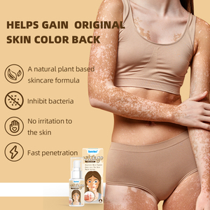 Crème Pommade Soulageant les Taches Blanches pour le Corps Traitement aux Plantes pour la Peau Crème pour le <span class=keywords><strong>Vitiligo</strong></span> Plâtre Chinois Ciblé pour l'Élimination des Taches - Product Image 6