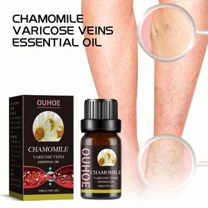 OUHOE Vente en gros OEM Soin de la peau Réparation des <span class=keywords><strong>varices</strong></span> Sérum <span class=keywords><strong>pour</strong></span> éliminer les <span class=keywords><strong>varices</strong></span> Traitement des <span class=keywords><strong>varices</strong></span> <span class=keywords><strong>Huile</strong></span> <span class=keywords><strong>essentielle</strong></span> de camomille 10 ml - Product Image 4