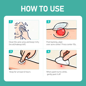 Nouveauté : Patchs Hydrocolloïdes Transparents pour l'Acné, Emballage Personnalisé avec Logo, Traitement des Boutons et Imperfections du Visage, Tous Types de Peau, Vente en Gros - Product Image 2