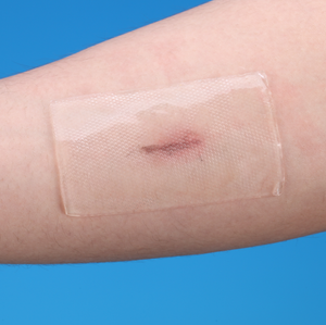 <span class=keywords><strong>Pansement</strong></span> en gel de silicone anti-UV <span class=keywords><strong>pour</strong></span> prévenir la pigmentation des cicatrices - Product Image 1