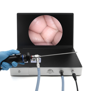 Juego de endoscopio rígido médico, artroscopio HD de 0 30 70 grados 4*175mm con cánula de trocar de vaina de artroscopia - Product Image 6