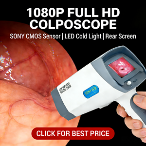 Système de colposcopie numérique portable à main, outil de diagnostic vidéo électronique pour les examens de santé des femmes - Product Image 1