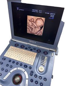 Fourniture et réparation de la machine à ultrasons portable Voluson e VolusonE Voluson.e - Product Image 1