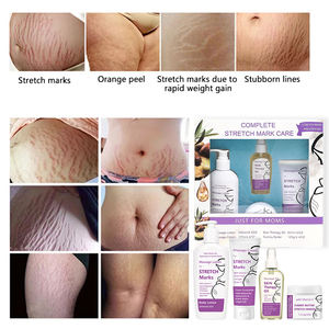 Crème <span class=keywords><strong>anti</strong></span>-vergetures de marque privée, lotion éclaircissante pour le corps, meilleure crème pour les vergetures de <span class=keywords><strong>grossesse</strong></span>, ensemble de crème - Product Image 6