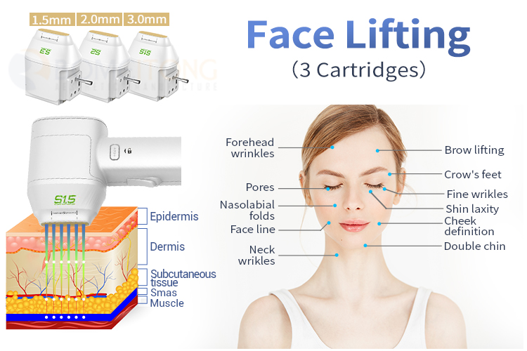 New Generation Hifu Shaping Facial Rejuvenation Machine