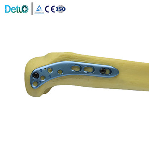 Placa <span class=keywords><strong>de</strong></span> Bloqueo Lateral Tibial Proximal 5.0 para Osteotomía Tibial Alta, <span class=keywords><strong>Implante</strong></span> Ortopédico <span class=keywords><strong>de</strong></span> <span class=keywords><strong>Precio</strong></span> Competitivo, Venta Caliente - Product Image 5
