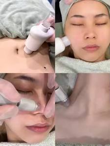 Máy làm sạch da mặt bằng rung EMS, hút chân không tạo bọt nhỏ, công nghệ điện di, loại bỏ mụn đầu đen, phiên bản mới nhất 2025 - Product Image 6