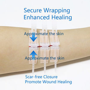 Ritsleting medis sulam kulit peregangan dan aman penutup luka Strip penutup luka perangkat ritsleting - Product Image 4