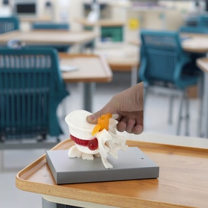 Modèle d'anatomie de la colonne vertébrale humaine avec hernie discale, en PVC écologique, pour la formation en écoles de médecine - Product Image 1