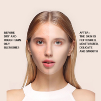 Sérum Visage Éclaircissant et Réparateur à la Vitamine C et à l'Acide Hyaluronique Anti-rides Hydratant Anti-âge Améliore la Pigmentation et les Ridules OBM