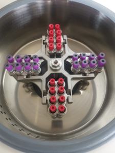 Kl06a 6000Rpm Tafelblad Lcd Touchpad 3l Lage Snelheid Grote Capaciteit Medische Laboratorium <span class=keywords><strong>Centrifuge</strong></span> - Product Image 3