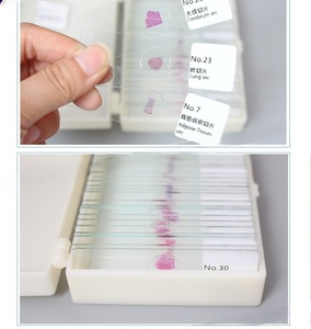 Lames préparées d'œufs de <span class=keywords><strong>nématodes</strong></span> mixtes, spécimens de parasitologie médicale, lames de microscope en verre et plastique pour l'enseignement médical scolaire - Product Image 3