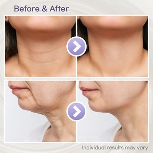 Private Label Centella Shea burro idratante Lifting antirughe sbiancamento rassodante <span class=keywords><strong>crema</strong></span> <span class=keywords><strong>per</strong></span> il <span class=keywords><strong>collo</strong></span> <span class=keywords><strong>per</strong></span> la pelle cascante - Product Image 5