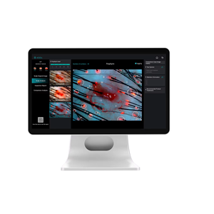 Machine d'analyseur de cheveux de test cutané/dispositif d'analyseur de scanner facial/analyse de scanner de cheveux et de peau - Product Image 1