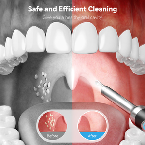 R1 nhà sản xuất bán buôn Intra miệng máy ảnh Intra miệng máy ảnh tiêu chuẩn 10MP intraoral wifi không dây intraoral máy ảnh Intra Miệng - Product Image 3