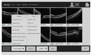 Tomografía de Coherencia Ó<span class=keywords><strong>ptica</strong></span> OCT-500 de Alta Precisión y Tecnología Avanzada, Mejor Precio, Gran Venta - Product Image 5