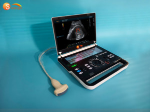 Échographe Doppler Couleur Numérique Portable 3D 4D avec Système et Accessoires – <span class=keywords><strong>Prix</strong></span> - Product Image 4