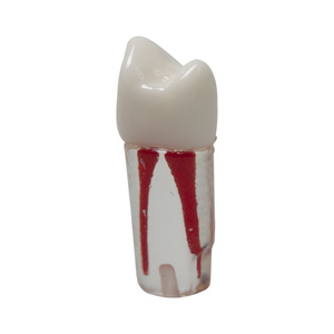 Resina de Práctica para Exámenes Dentales, Partículas de Dientes Simulados para Endodoncia, Extracción de Dientes, Terapia de Pulpa, Accesorio para Equipo Dental - Product Image 4