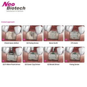 <span class=keywords><strong>Kit</strong></span> <span class=keywords><strong>GBR</strong></span> per Impianti Dentali Neobiotech, <span class=keywords><strong>Kit</strong></span> di Rigenerazione Ossea Guidata per Chirurgia Implantare, <span class=keywords><strong>Kit</strong></span> EZ-<span class=keywords><strong>GBR</strong></span> Originale per Strumenti Dentali Ospedalieri - Product Image 5