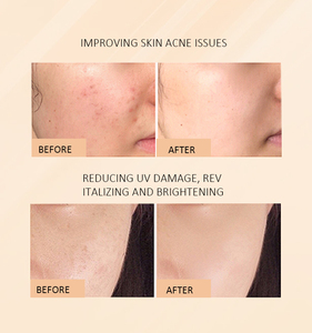 Сыворотка для лица <span class=keywords><strong>OEM</strong></span> с индивидуальным логотипом: от акне, морщин, для омоложения и увлажнения кожи - Product Image 4