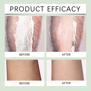 Crème dépilatoire naturelle à base de plantes en gros pour une épilation indolore du visage et du corps - Product Image 6
