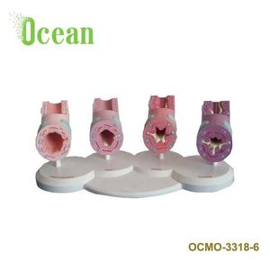 Modè<span class=keywords><strong>le</strong></span> de bronchies asthmatiques normales, modè<span class=keywords><strong>le</strong></span> médical de pathologie trachéale pour la publicité, l'éducation <span class=keywords><strong>et</strong></span> la démonstration - Product Image 3