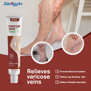 Ungüento para venas varicosas, venas, dolor, vasculitis, flebitis, pierna de araña, cuidado de la salud, crema de hierbas, alivia el dolor de piernas, suavizante - Product Image 3