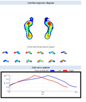 Prix direct usine : Analyseur de pression plantaire pour podologie, analyse de la marche, orthèses de pied, scanner USB, plaque de mesure de pression plantaire, certifié CE