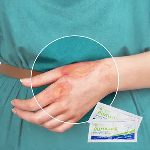 Manufacturer Medical Emergency Burn Wound Care Hydrogel Dressing Relieve Burn Gel and Dressing