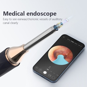 Outil de nettoyage d'oreilles électrique sans fil Wi-Fi, kit d'élimination du cérumen, otoscope 1080P avec caméra et lumière pour le nettoyage des oreilles - Product Image 3
