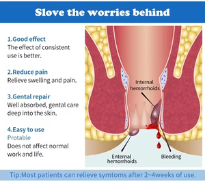ครีมสมุนไพรจีน OEM สำหรับรักษาแผลรั้งทวารหนัก บรรเทาอาการริดสีดวงทวารทั้งภายในและภายนอก ดูแลสุขภาพอย่างรวดเร็ว - Product Image 6
