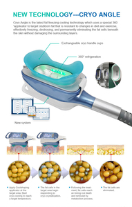 Machine de <span class=keywords><strong>cryolipolyse</strong></span> professionnelle à 360 degrés avec technologie Lipo Laser et double radiofréquence pour le remodelage corporel - Product Image 6