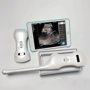 192 Element Phased Array cardiaco, lineare e convesso 3 in 1 Scanner ad ultrasuoni Color Doppler portatile - Product Image 6