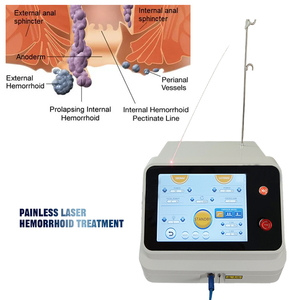 फाइबर लेजर काटने वाले नरम ऊतक anal fissssurfetula 980 1470nm सर्जिकल प्रॉक्टोलॉजी लेजर - Product Image 6