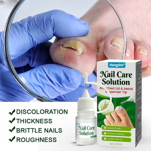 Solution réparatrice pour les ongles atteints <span class=keywords><strong>de</strong></span> mycose, améliore efficacement les ongles épais et abîmés, soin topique liquide sûr - Product Image 3