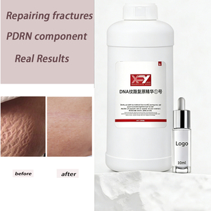 PDRN Lines DNA Regeneration Stretch Mark <span class=keywords><strong>Camouflage</strong></span> pour Kit de Microblading pour l'Académie Crème Anti-Vergetures - Product Image 1
