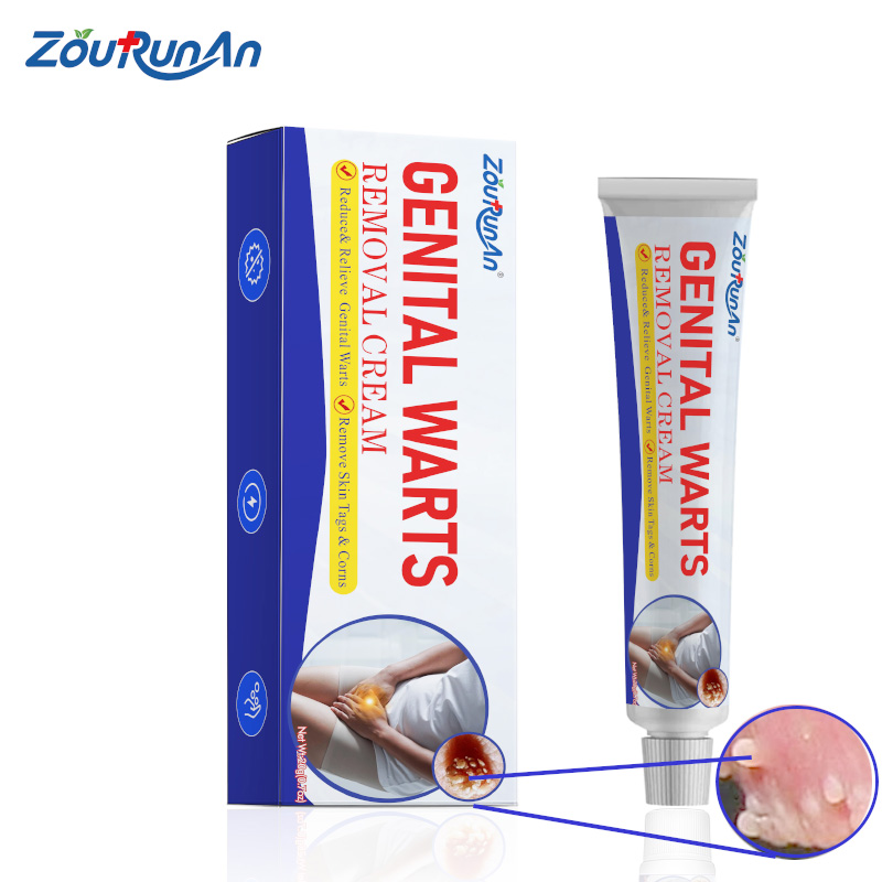 ZouRunAn Wholesale Warts Soothe Skin Tag Mole Remover Ointment Cream Herbal Extract Genital Wart Removal Ointment