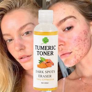 Soin Visage Naturel Bio Éclaircissant Anti-Taches Hydratant Nourrissant Réparateur Acné Tonique au Curcuma - Product Image 6