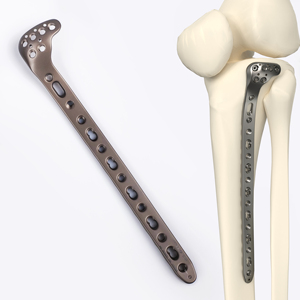 CANWELL Titanium <strong>Proximal</strong> Tibial Locking Plate Orthopedic Implant Trauma Fracture Fixation Bone Surgery System CE - Product Image 1