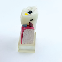 Modelo Anatómico de Molar Patológico Dental de 4 Veces el Tamaño Real, Simulación de Perfil de Caries, Modelo de Enseñanza para Entrenamiento Dental