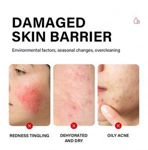 Mooyam Spray et Sérum de Secours SOS en 15 Minutes pour Réparer les Rougeurs et Apaiser la Peau, Modèle de Secours Intensif - Product Image 6