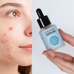 20% Vitamina C Tumeric Aloe Vera Facial Anti Acné Poro Serum Soluciones 15 Ml - Product Image 1