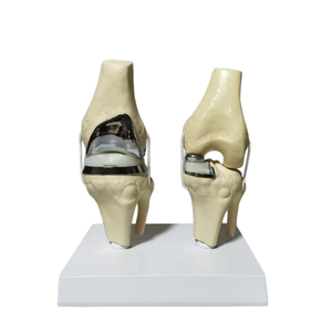 Hoogwaardig PVC afneembaar kunstmatig klein dubbel zilveren kniegewricht implantaat modelset medisch wetenschappelijk oefenmodel voor protheses - Product Image 1