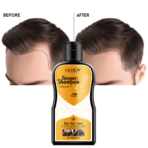 Shampoo <span class=keywords><strong>anti</strong></span>-<span class=keywords><strong>chute</strong></span> de cheveux en marque privée, <span class=keywords><strong>meilleur</strong></span> shampooing contre la perte de cheveux, shampooing <span class=keywords><strong>anti</strong></span>-<span class=keywords><strong>chute</strong></span> - Product Image 1