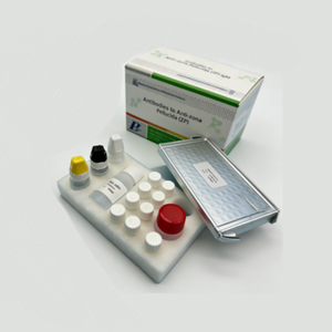 Anticorps à faible prix pour l'anticorps IgM anti-zona pellucida (ZP) compatibles avec les <span class=keywords><strong>types</strong></span> d'échantillons cliniques courants tels que le sérum et le plasma - Product Image 6