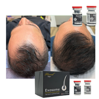 Esensi Eksosom Label Pribadi untuk Pertumbuhan Rambut, Larutan Serum Eksosom, OEM Eksosom