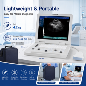 Appareil d'échographie portable <span class=keywords><strong>de</strong></span> 4,2 kg avec 16 Go <span class=keywords><strong>de</strong></span> stockage, écran LED HD <span class=keywords><strong>de</strong></span> 15 pouces, scanner <span class=keywords><strong>de</strong></span> diagnostic vétérinaire avec deux ports pour sondes - Product Image 5